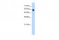 SMARCD2 antibody - C-terminal region
